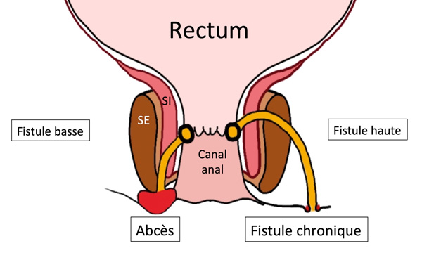 schema rectum